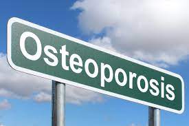 Osteoporosis Sign