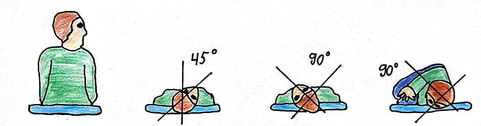 Epley maneuver illustrated